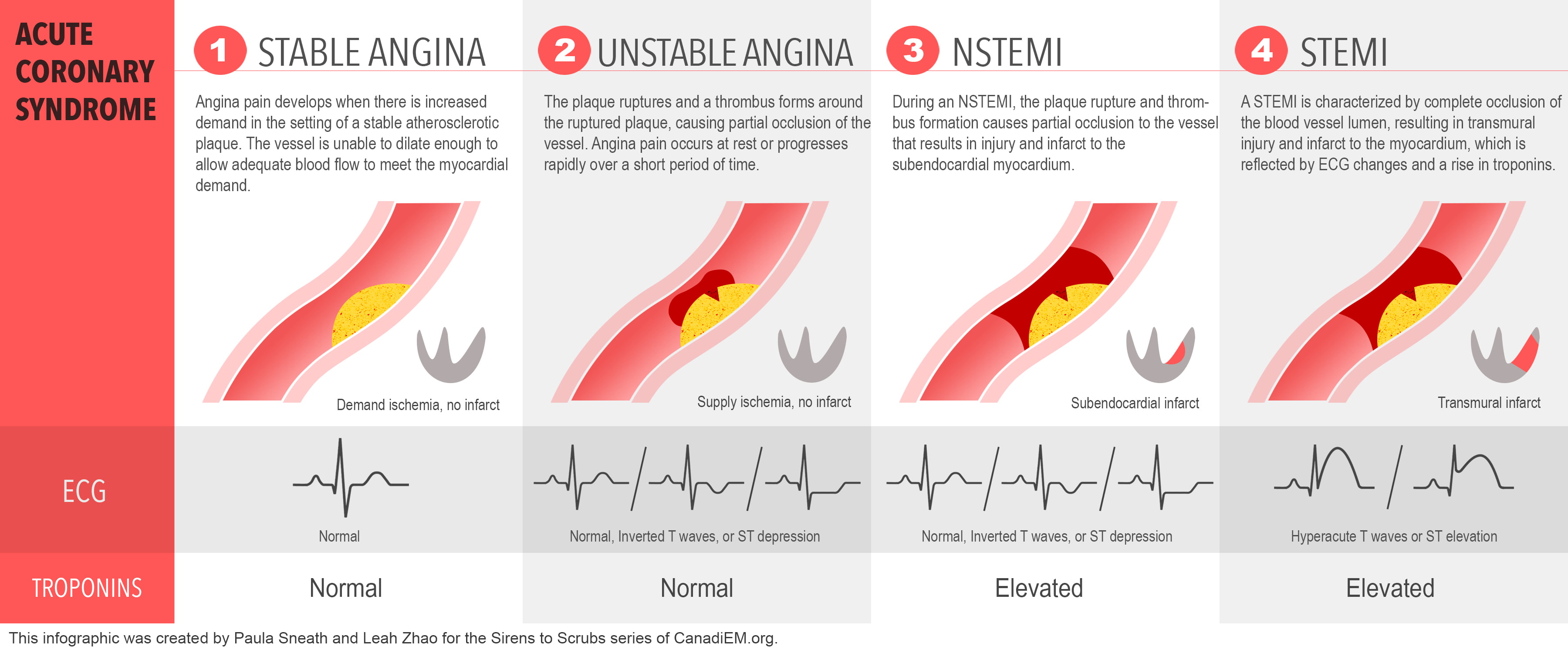 sirens-to-scrubs-acute-coronary-syndromes-part-one-beyond-door-to