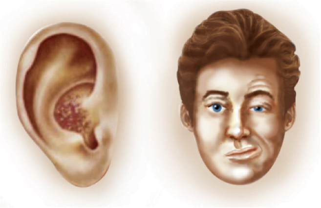 Neurontin dosage for diabetic nerve pain