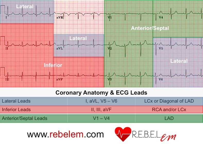 CRACKCast E078 - Acute Coronary Syndromes Part A - CanadiEM