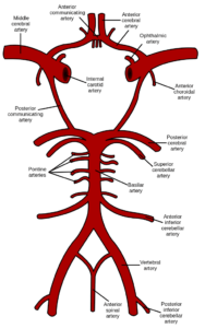 CRACKCast E101 - Stroke - CanadiEM