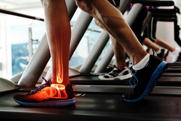 Tiny Tips “TREADMILLS” Peripheral Neuropathy mnemonic CanadiEM