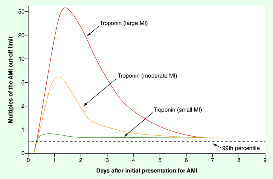 Stemi Vs Nstemi Troponin Levels