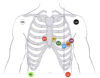 CanadiEM Frontline Primer – Monitor Leads & ECGs - CanadiEM