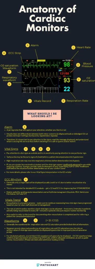 https://canadiem.org/wp-content/uploads/2020/05/Cardiac-Monitoring-Infographic-edited-2-copy-363x1024.png.webp