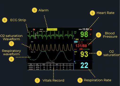 CÁCH ĐỌC CÁC THÔNG SỐ HIỂN THỊ TRÊN MONITOR THEO DÕI BỆNH NHÂN | CÔNG TY THIẾT BỊ Y TẾ HOÀNG MINH