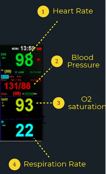 How to Read A Vital Signs Monitor 