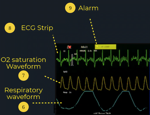 understanding-readings-on-a-patient-monitor-coast-biomedical-equipment