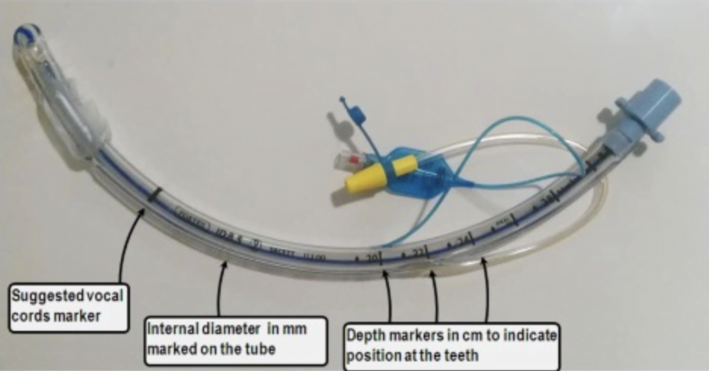 Tiny Tips: Pediatric Airway Anatomy Considerations - CanadiEM