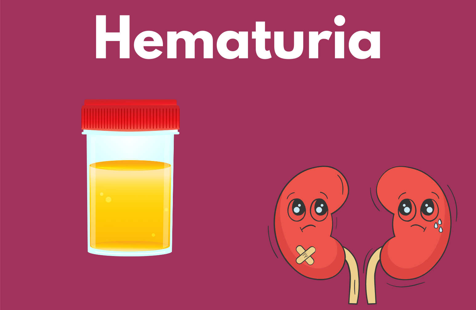 Tiny Tips: Hematuria: IS THIS PP RED? - CanadiEM